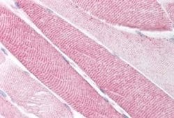 NK2R Antibody, Novus Biologicals 50 &mu;g; Unconjugated:Antibodies, Polyclonal